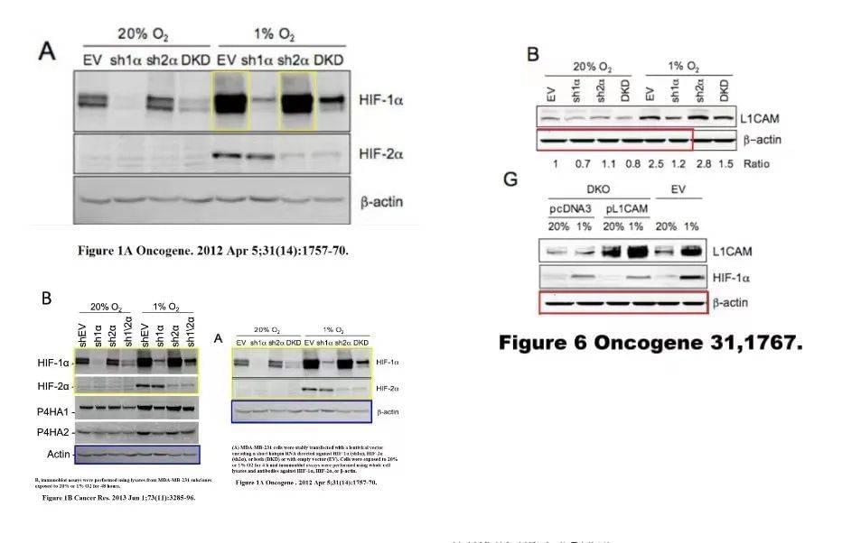 《HIF-1-dependent expression血管生成素样4和L1CAM介导缺氧乳腺癌细胞向肺部的血管转移癌》基因(2012) doi: 10.1038/onc.2011.365