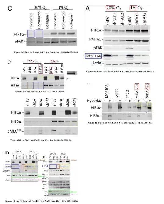 《缺氧诱导因子介导乳腺癌细胞中协调的RhoA-ROCK1表达和信号传导》 PNAS(2014) doi: 10.1073/pnas.1321510111