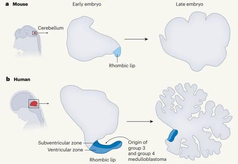 ▲人类小脑发育过程中，菱唇（rhombic lip）结构内特定细胞群的分化缺陷是髓母细胞瘤第3、第4亚型的起源（图片来源：参考资料[3]）<br label=图片备注 class=text-img-note>