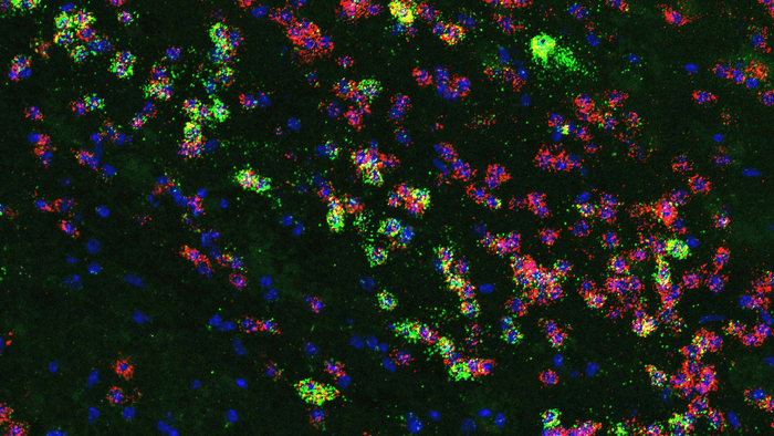 研究团队发现，图中绿色的神经元能诱导享乐型进食行为（图片来源：Bo Li Lab/CSHL/2022）<br>