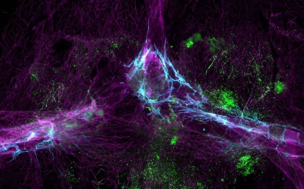 图1 | 大脑的免疫系统包括血管运输网络（蓝色）和骨髓中产生的自身免疫细胞（绿色）。图片来源：Siling Du， Kipnis lab， Washington University in St. Louis
