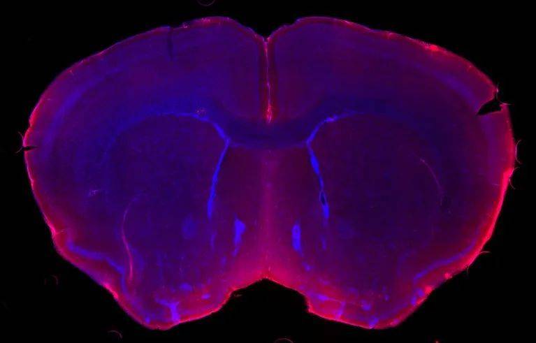 图3 | 脑脊液（红色）通过流经大脑保护层的血管中的微小缝隙渗入脑组织（蓝色）。图片来源：Antoine Drieu， Kipnis lab， Washington University in St. Louis