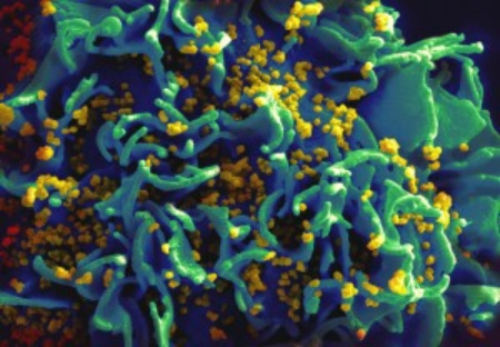 感染人源T细胞的HIV病毒颗粒 