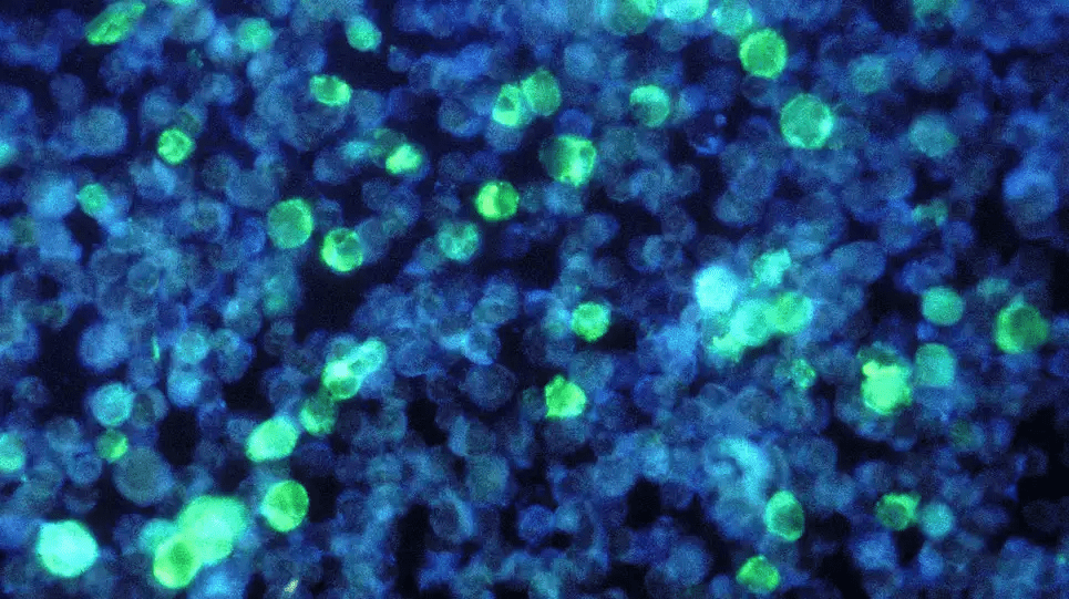 图中绿色部分是被EB病毒感染的白血病细胞<br>