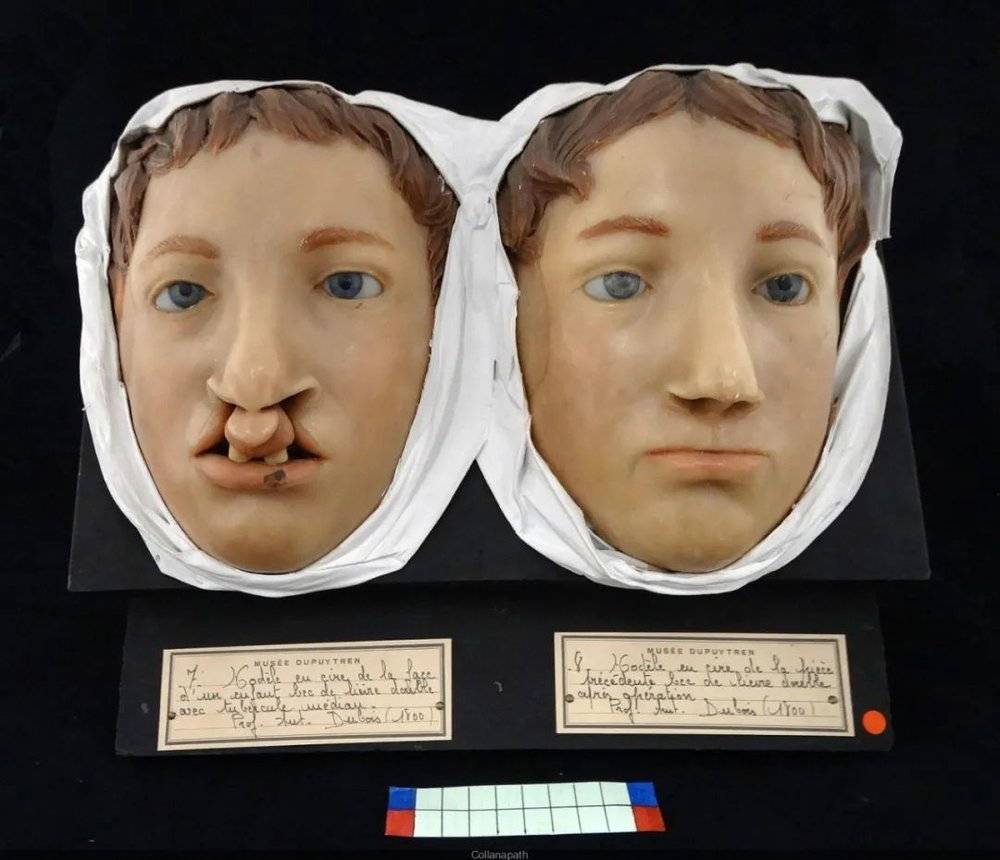 杜普伊特伦博物馆内拥有4800多件描绘罕见缺陷和疾病的解剖蜡模型。© Sortir à Paris