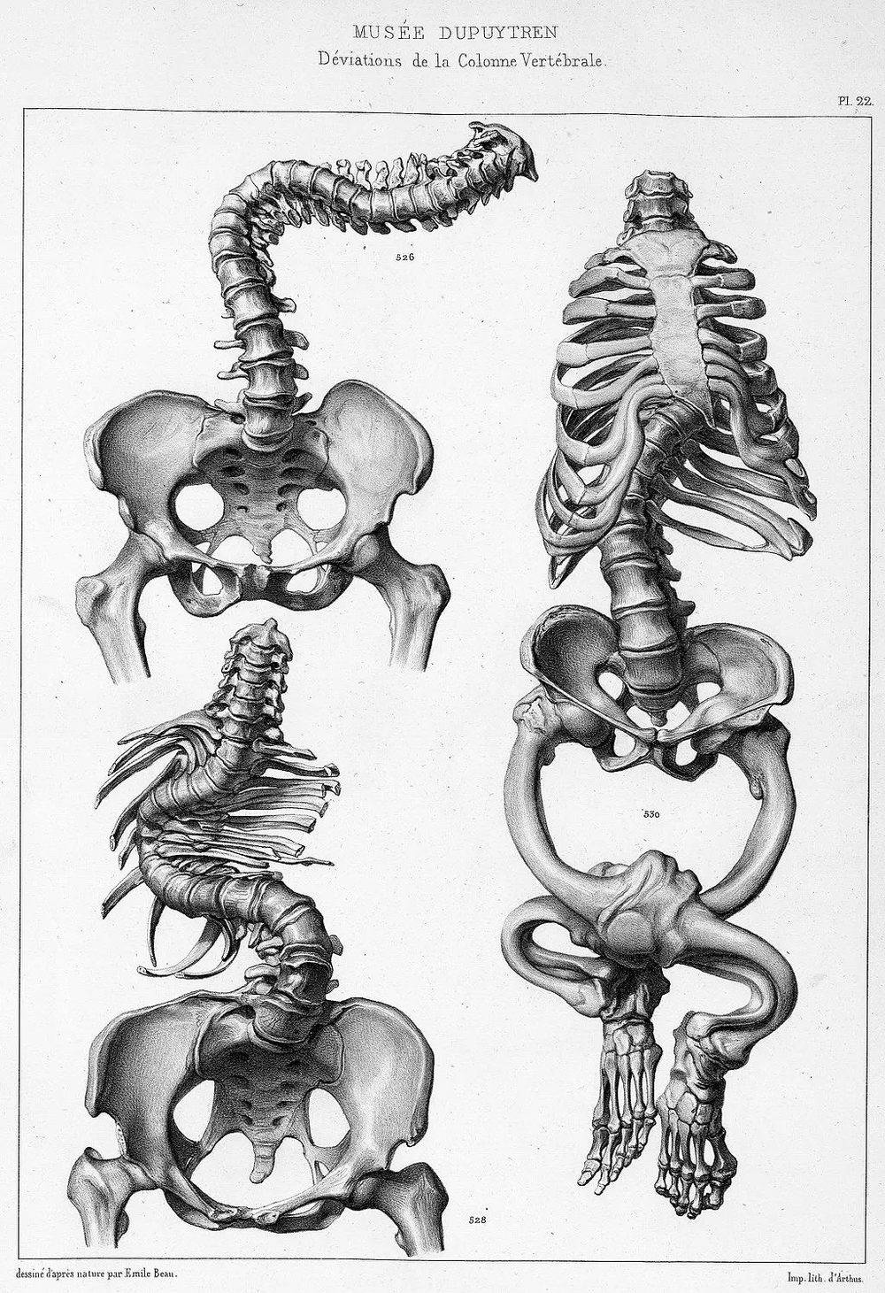 法国解剖学家查尔斯-皮埃尔·德农维利尔（Charles-Pierre Denonvilliers）曾在1836年至1842年间编撰了博物馆约1000件藏品的目录，上图便出自该目录。© Wikipédia