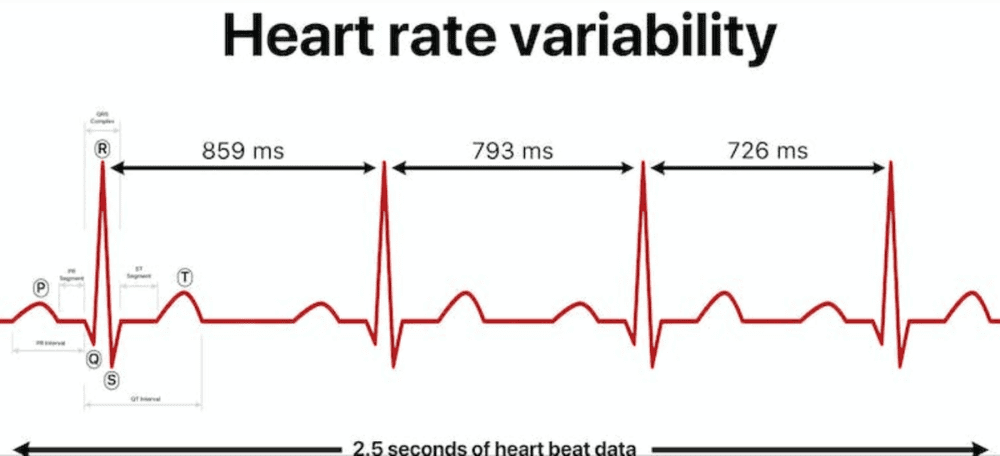 上方的心率图表明心跳峰值之间的间隔存在微小差异