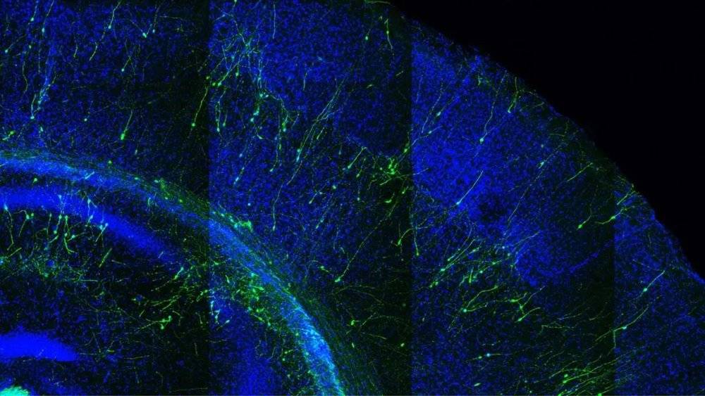 从干细胞制得的人类神经元细胞（绿色）在移植到小鼠大脑内两周后的情况。来源：Pierre Vanderhaeghen<br>