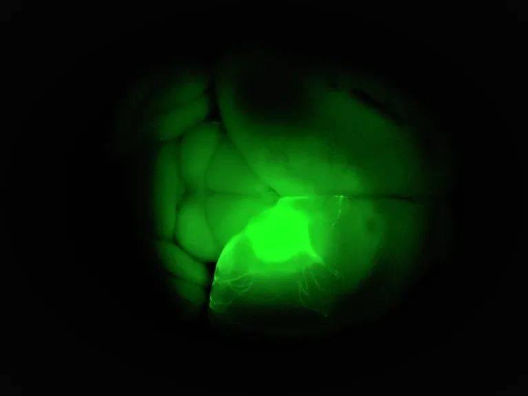 科学家将人类类器官（亮绿色）移植到小鼠大脑中，以研究神经元细胞在健康和疾病背景下的细胞行为。来源：Abed Mansour<br>