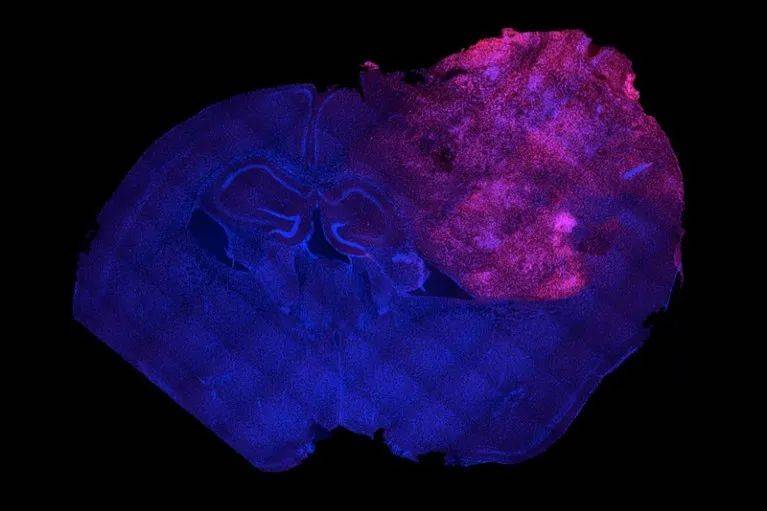 由干细胞制成的人类脑细胞（紫色）在小鼠大脑（蓝色）的部分区域中生长。来源：Raquel Real， Manuel Peter， Rick Livesey and Vincenzo De Paola<br>