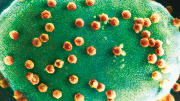 绿藻病毒颗粒会感染微型的绿藻。（图/Kit Lee and Angie Fox via unl.edu）<br>