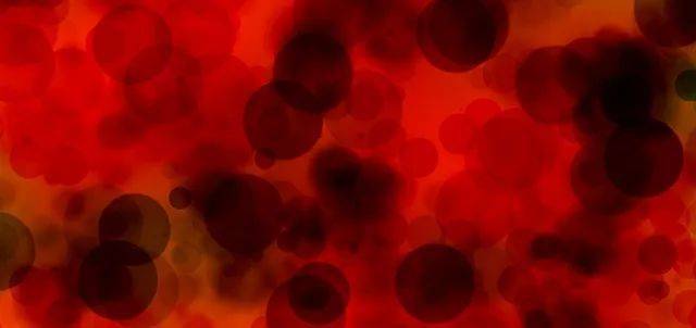 不推荐丙种球蛋白和恢复期血浆来救治新冠｜pixabay<br>