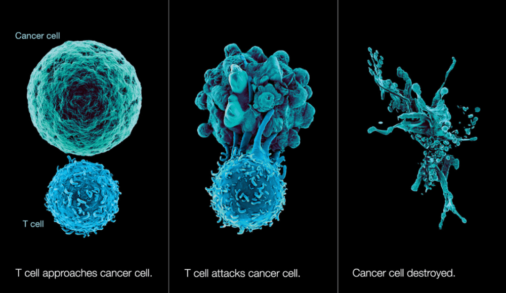 免疫细胞杀死癌细胞，图源：North Shore University Health System