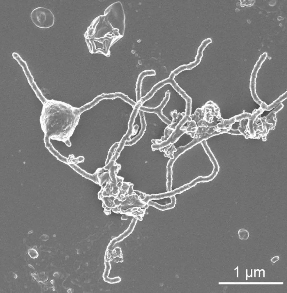 研究人员于 2015 年从宏基因组数据中首次鉴定出阿斯加德古菌，它被认为是与现代真核生物最接近的现存原核生物。几年后，第一个阿斯加德古菌Candidatus Prometheoarchaeum syntrophicum被培养出来，揭示了其生物学的独特方面。HIROYUKI IMACHI， MASARU K. NOBU， AND JAMSTEC<br>