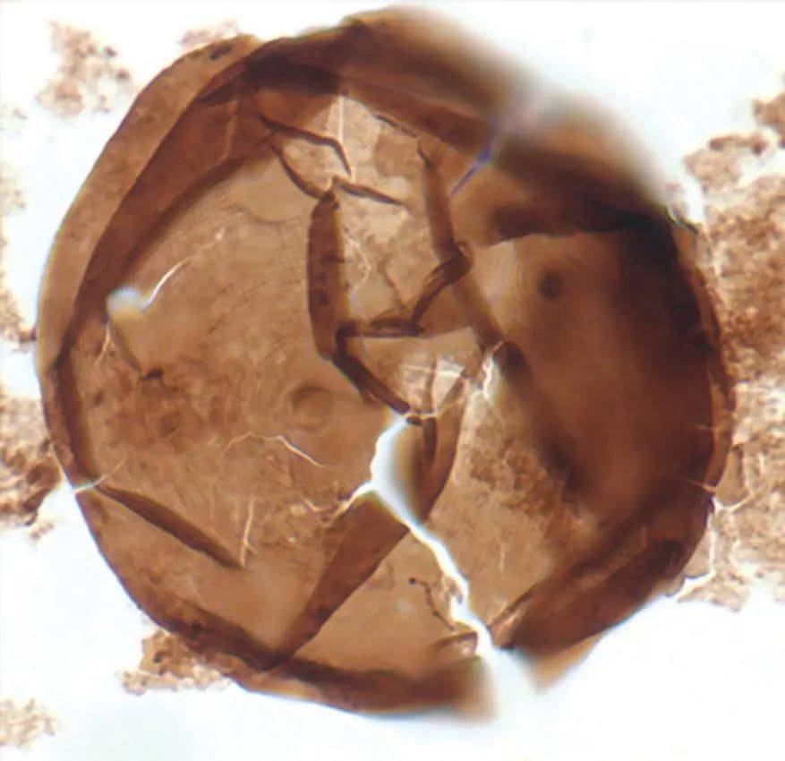 7.5亿年历史的微化石 Valeria lophostriata COURTESY OF SUSSANAH PORTER
