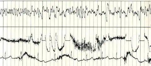 德鲁彦的脑电波，记录下了恋爱时的美丽心情，并存储于旅行者号的金唱盘中。来源：NASA