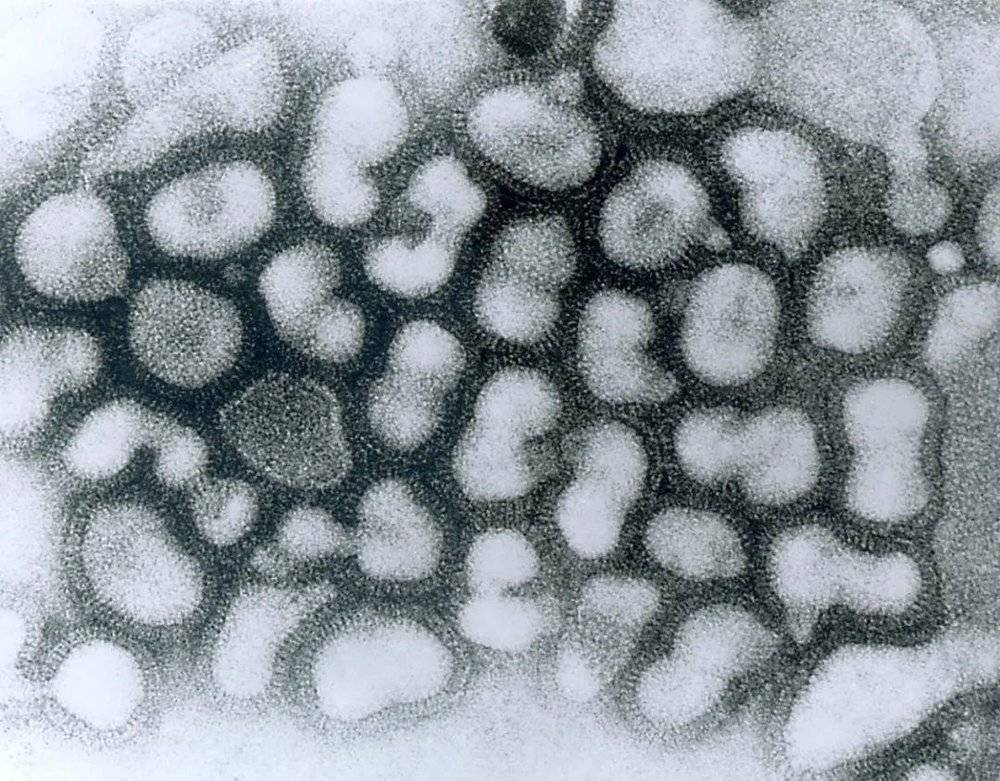 图/什么是甲型H1N1流感病毒？据世卫公布的相关说明，这是一种混合了猪流感、人类流感和禽流感病毒的新型病毒，以前从未在猪或人身上发现过，对这种病毒的科学认知现在还非常有限。H1N1流感于2009年暴发时，最初世界卫生组织使用了“猪流感”（swine flu）的名称，一度被误以为这是一种由猪传染给人的人畜共患疾病，使人们对猪和猪肉产生了恐慌。当年4月，世界卫生组织决定将其改名为甲型H1N1。2009年在墨西哥与美国暴发的这波“猪流感”疫情，影响了100多个国家，造成了至少14142例死亡。