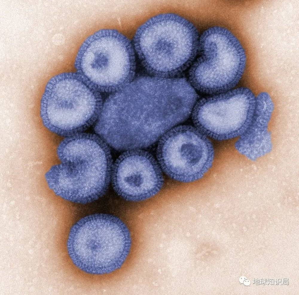 直到1899年，人类才第一次发现并命名“病毒”这一概念，此前还一直认为流感的罪魁祸首是细菌（流感病毒电镜观，图：Flickr）