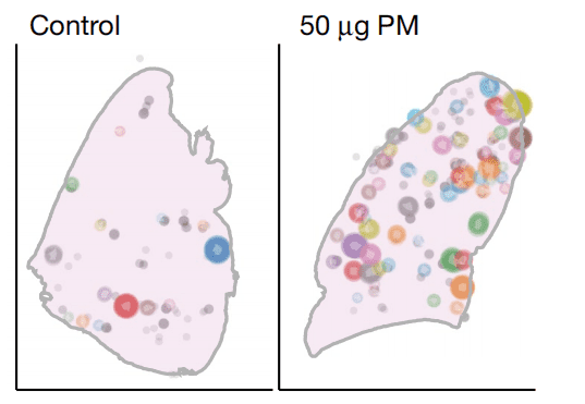 身处PM2.5颗粒浓度较高的环境（50μg）更容易出现肺癌。