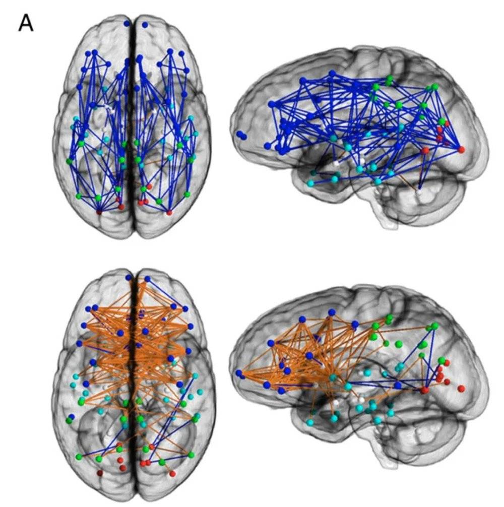 同脑区和同半脑连接更常见于男性大脑，而女性大脑则有更多的跨脑区和跨半脑连接 | Ingalhalikar， M.， …， and Ragini Verma. (2014). ‘Sex differences in the structural connectome of the human brain.’ PNAS.