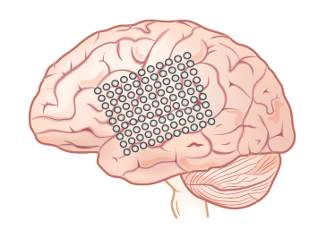 在过去，“读心”的脑机接口通常需要在大脑中植入芯片 | Nature Neuroscience